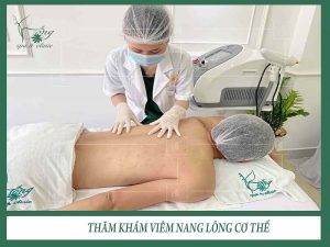 Spa trị mụn lưng - Bống Spa
