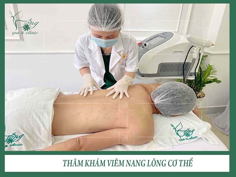 Spa trị mụn lưng - Bống Spa