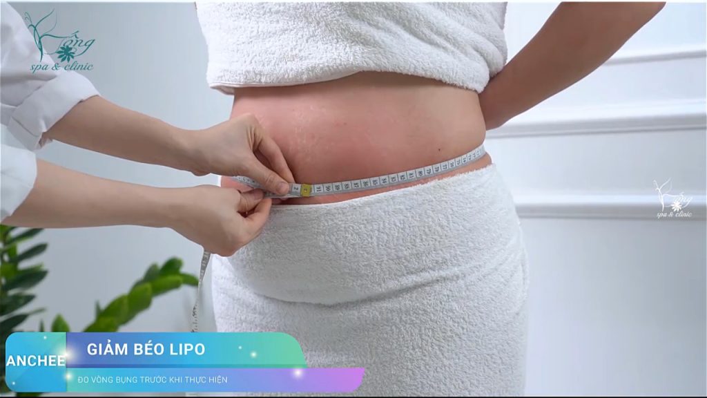 Giảm Mỡ Bụng Hiệu Quả Bằng Công Nghệ CAVI-LIPO