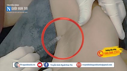 Nhân viên sử dụng thuốc gây tê dạng tiêm cho khách hàng