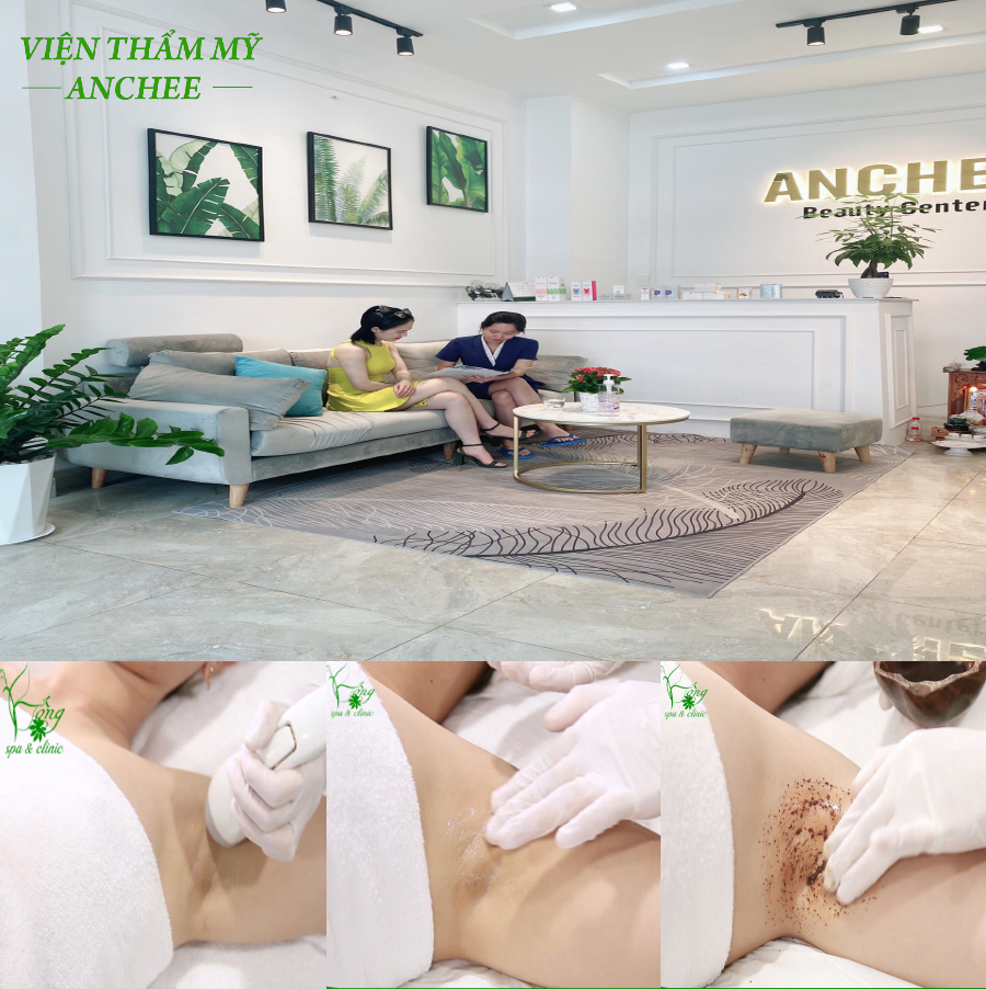 Spa Trị Thâm Nách Bao Nhiêu Tiền ? Laser + Bio chỉ #299K