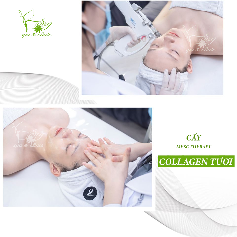 cay-collagen-tuoi