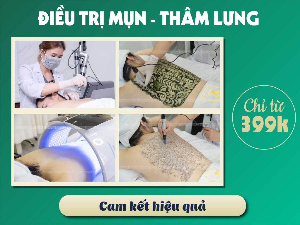 Spa Trị Mụn Lưng Hiệu Quả - Liệu Trình & Bảng Giá [2023]
