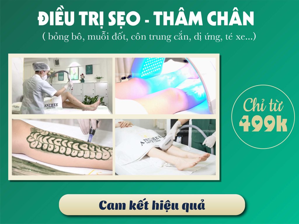 Bật Mí 5 loại kem trị vết thâm Ở chân lâu năm - trị sẹo thâm ở chân 2022