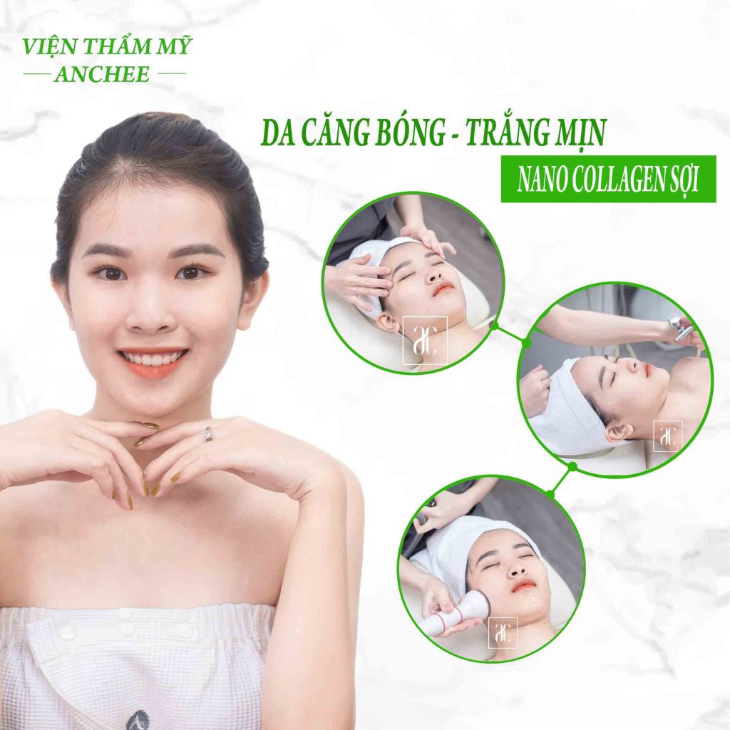 CẤY COLLAGEN SỢI