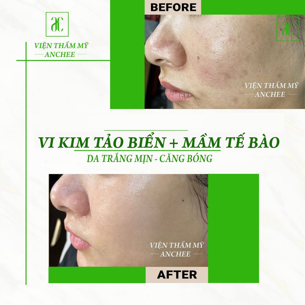 vi-kim-tao-bien