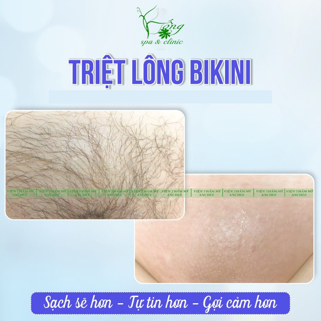 4+ Cách wax lông bikini tại nhà dễ làm - Bảng giá Spa #2022