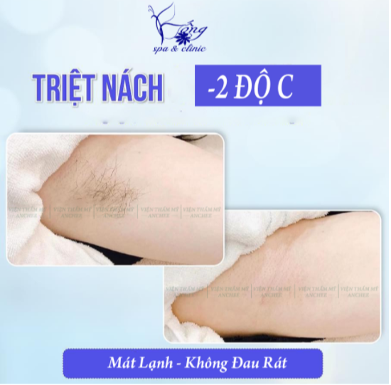 Top 7 cách wax lông nách tự nhiên tại nhà : Sạch - Mịn 2022
