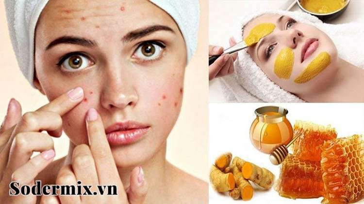 [Top] 5 Cách Làm Sẹo Thâm Biến Mất Sau 1 Tuần tại nhà #2022