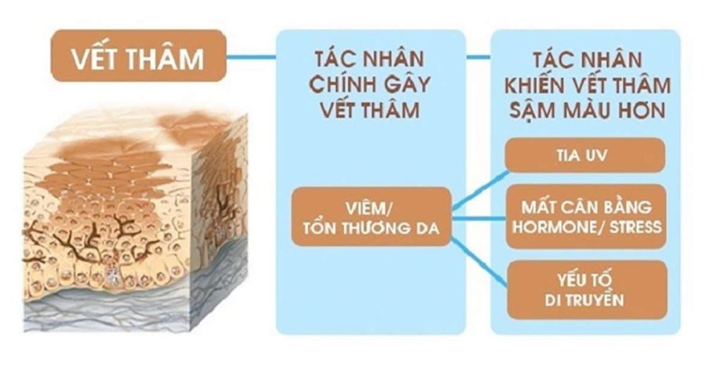 kem-tri-seo-tham