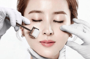 Lăn Kim Trị Nám - Hiệu quả hay không? Bao Nhiêu Tiền [2023]