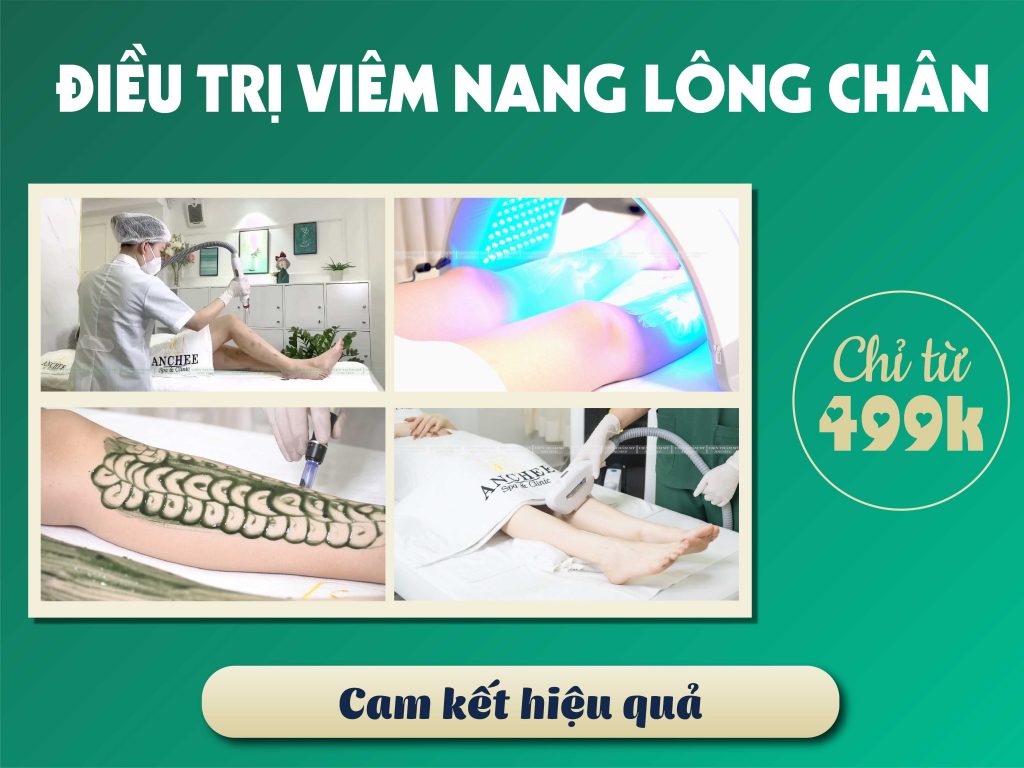 Lăn kim trị viêm nang lông : 6 điều bạn cần phải biết [2023]
