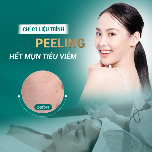 Peel Da Vi Tảo Retinol Có Tốt Không? Quy Trình - Địa Chỉ Uy Tín
