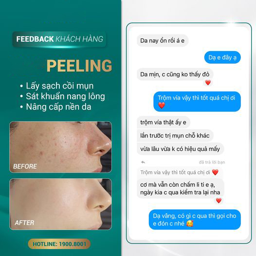 Peel Da Vi Tảo Retinol Có Tốt Không? Quy Trình - Địa Chỉ Uy Tín