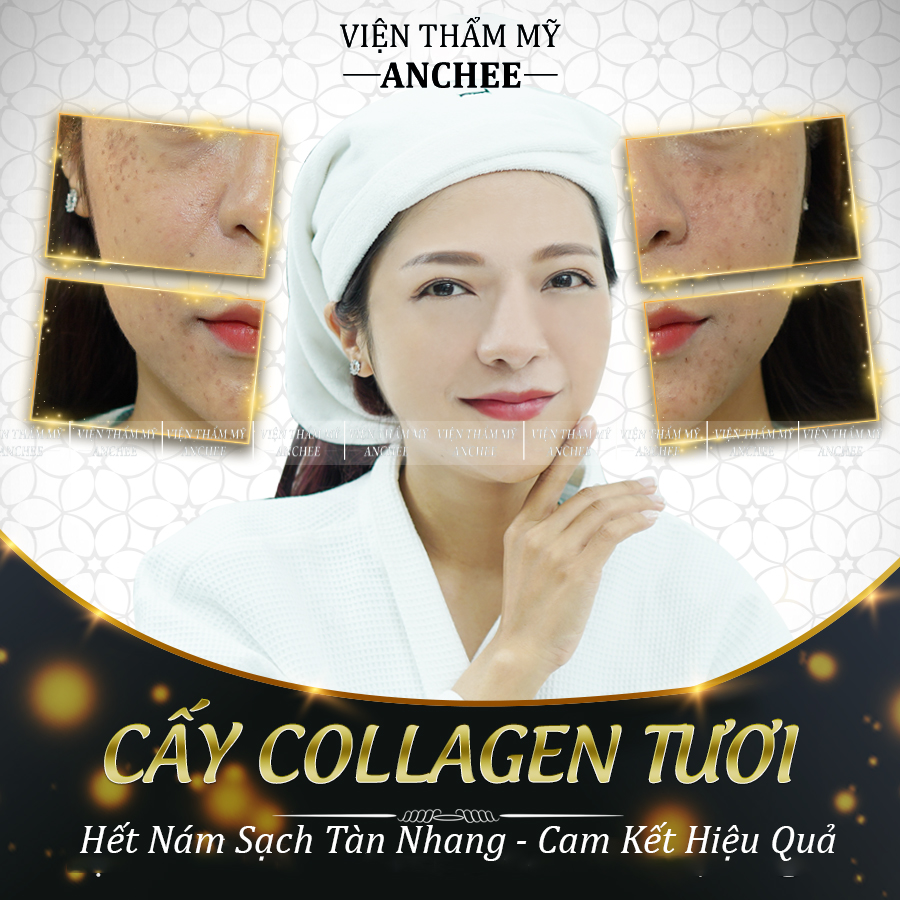 Sau khi đốt tàn nhang có nên rửa mặt không [Bác sĩ tư vấn]