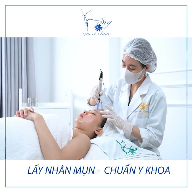 Spa nặn mụn - Bống Spa