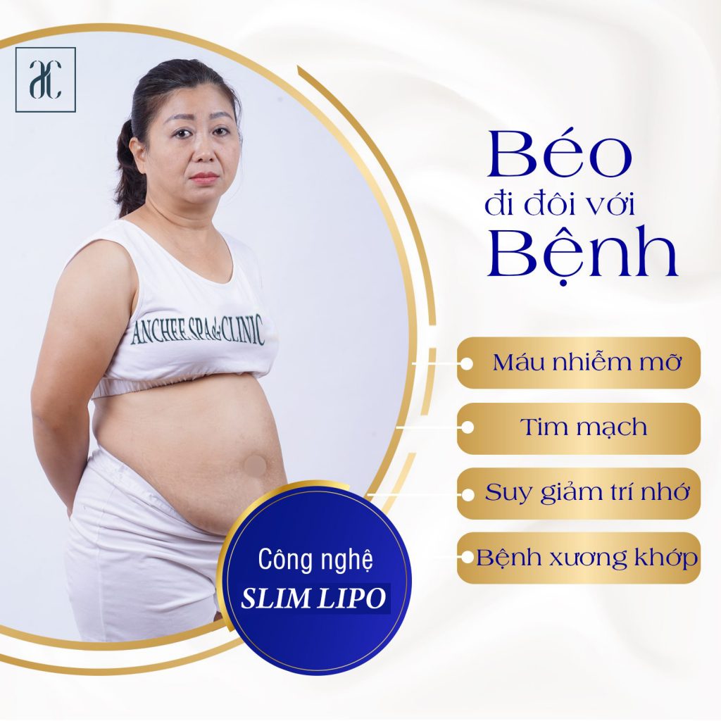 Tiêm tan mỡ hiệu quả không ? Giá bao nhiêu ? Lưu ý gì #2022
