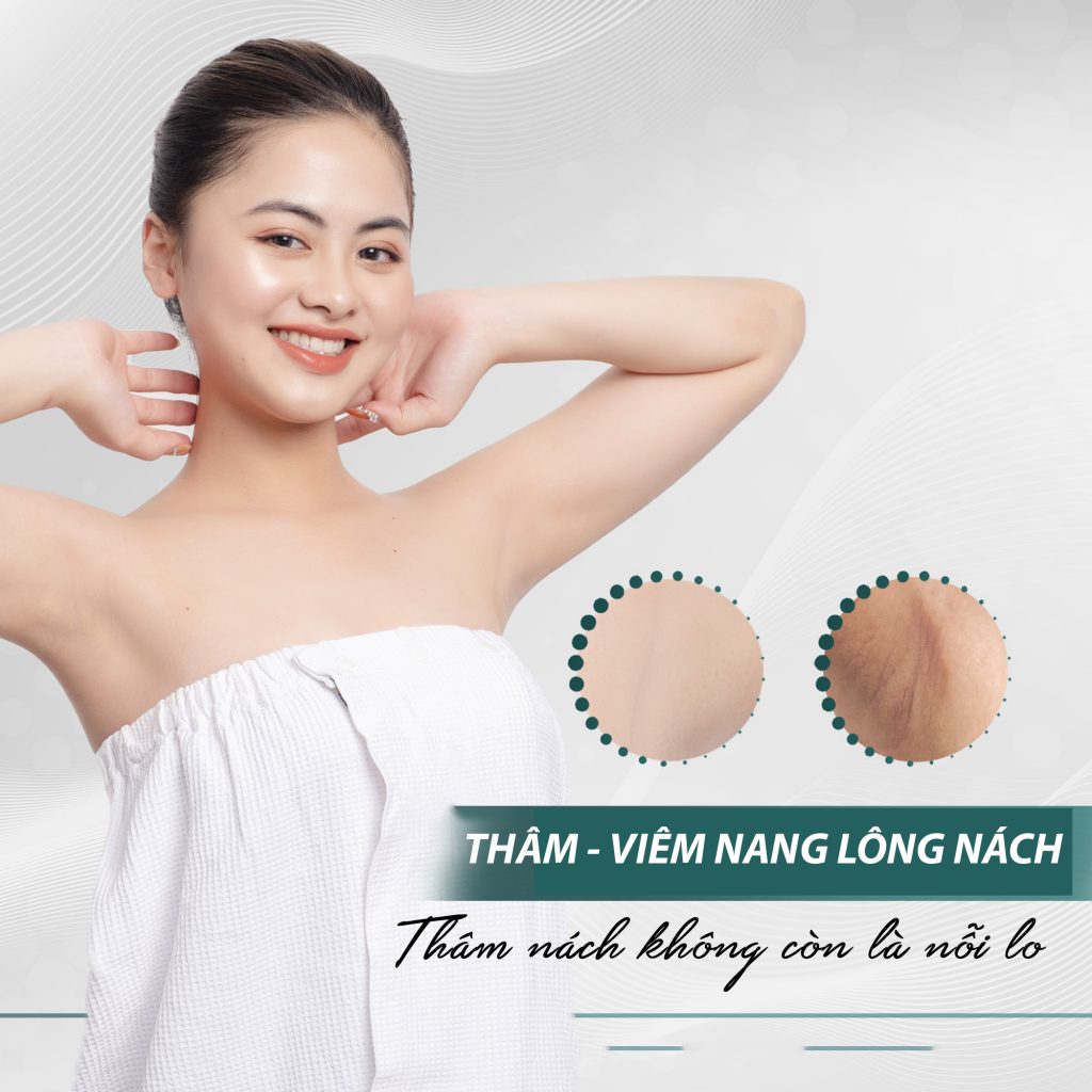 Spa Trị Thâm Nách Bao Nhiêu Tiền ? Laser + Bio chỉ #299K