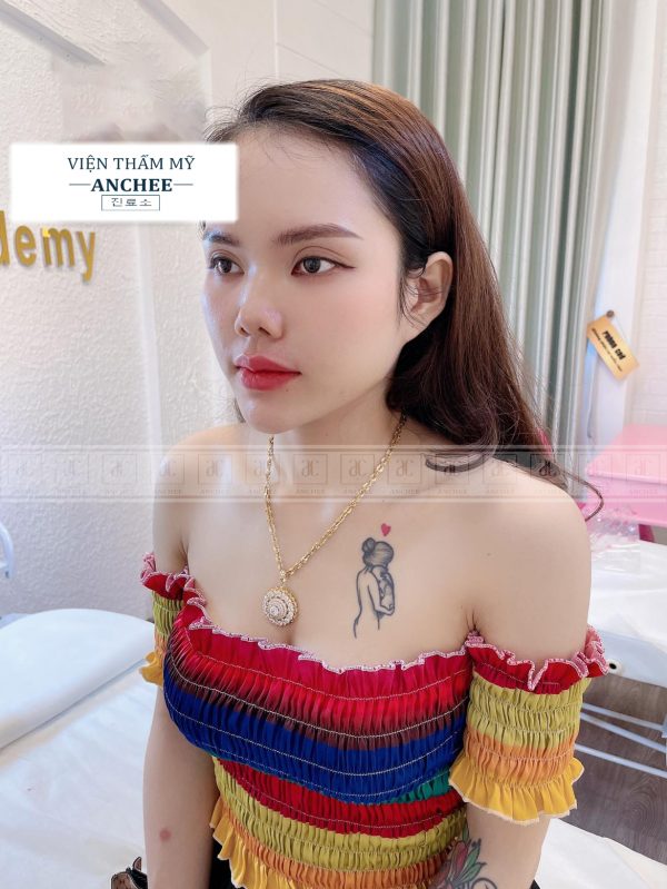 Tiêm Môi Tây Hợp Với Ai Top 9 Dáng Môi Sexy Đẹp Nhất 2024 