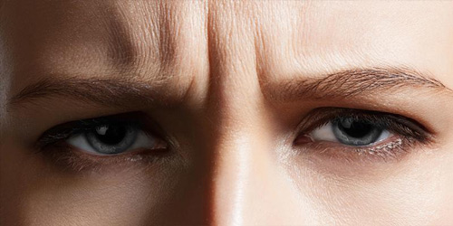 Nếp Nhăn Vùng Mắt : Nguyên nhân và 8 cách xóa nhăn tại nhà