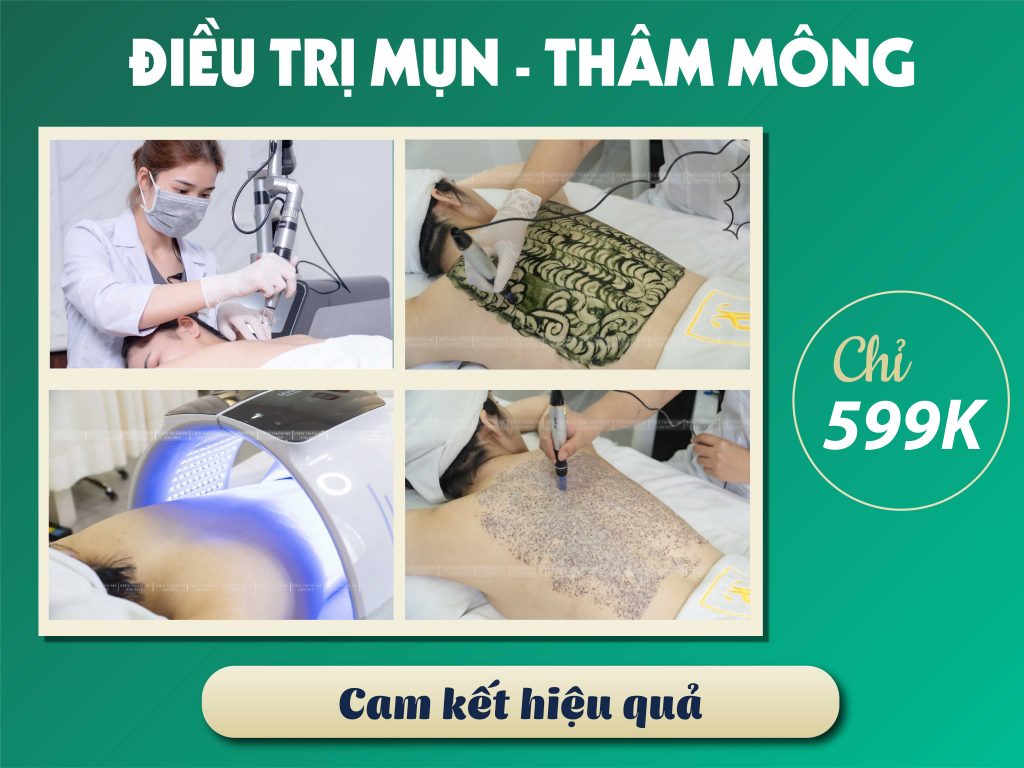 Top 11+ Kem trị thâm mông tốt nhất 2022 [bác sĩ khuyên dùng]