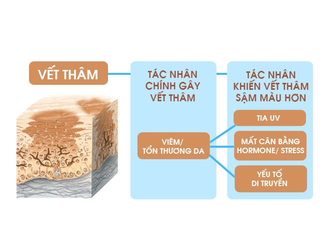 Top 11+ Thuốc Trị Sẹo Thâm Cấp Tốc hiệu quả và tốt nhất 2023