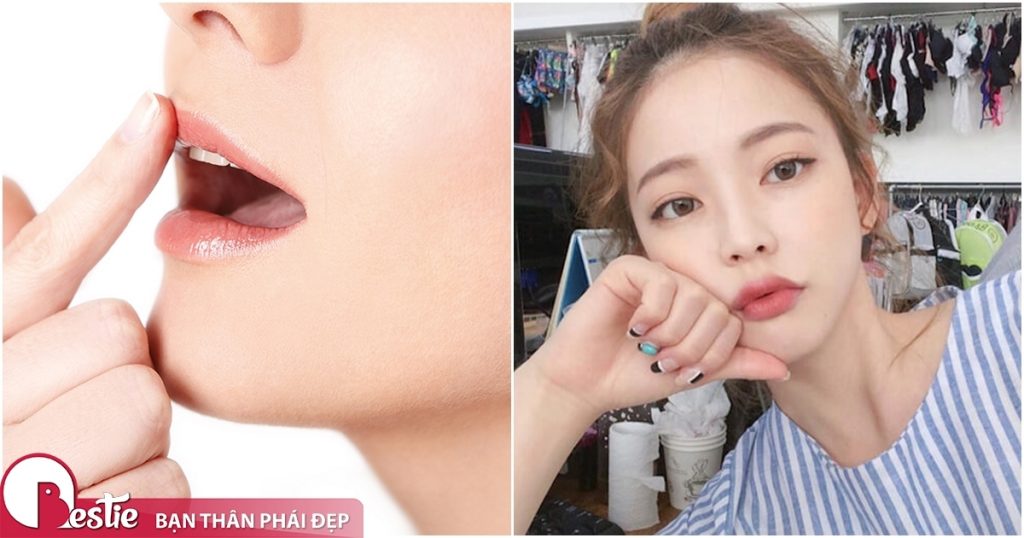 Tạo môi hình trái tim: Cẩn thận “tiền mất tật mang”