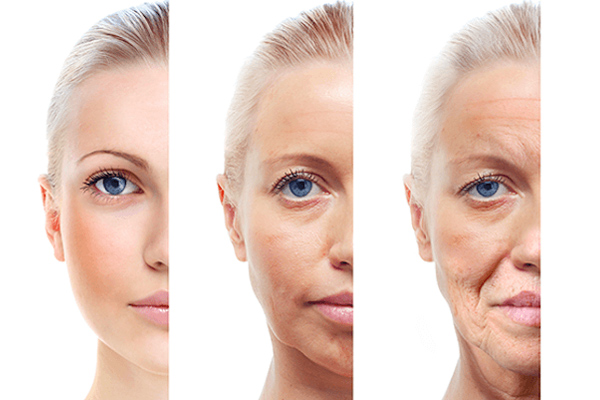 Rãnh cười là gì? 4+ Phương pháp xóa nếp nhăn rãnh cười 2023