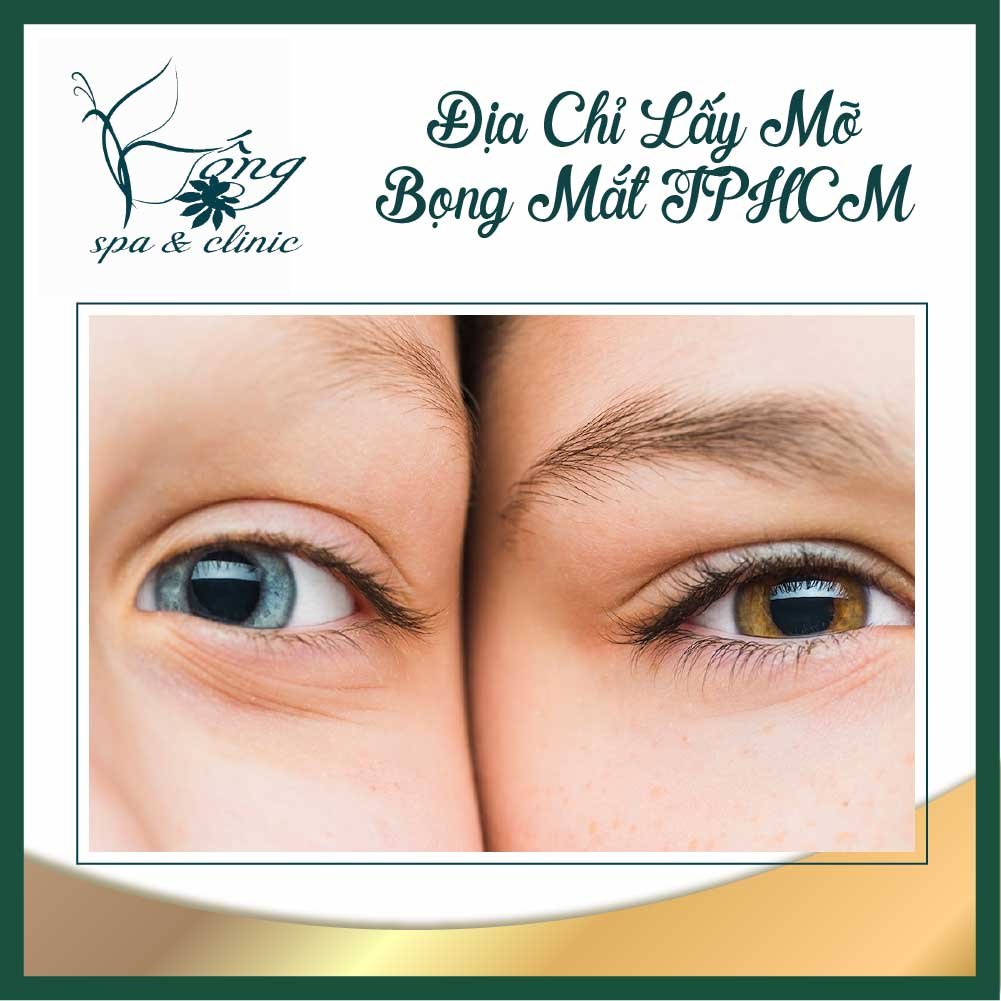 TOP 15 Địa Chỉ Lấy Mỡ Bọng Mắt TPHCM - Uy Tín An Toàn Và Nhanh Chóng