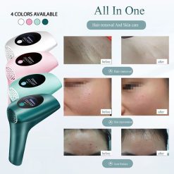 Máy triệt lông mini cầm tay S-life IPL