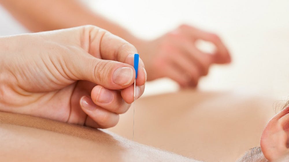 Cấy chỉ giảm béo - Phương pháp làm đẹp hiệu quả tối ưu nhất hiện nay