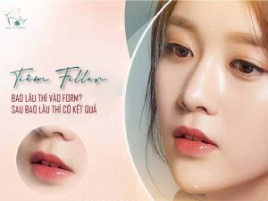 tiem-filler-bao-lau-thi-vao-form