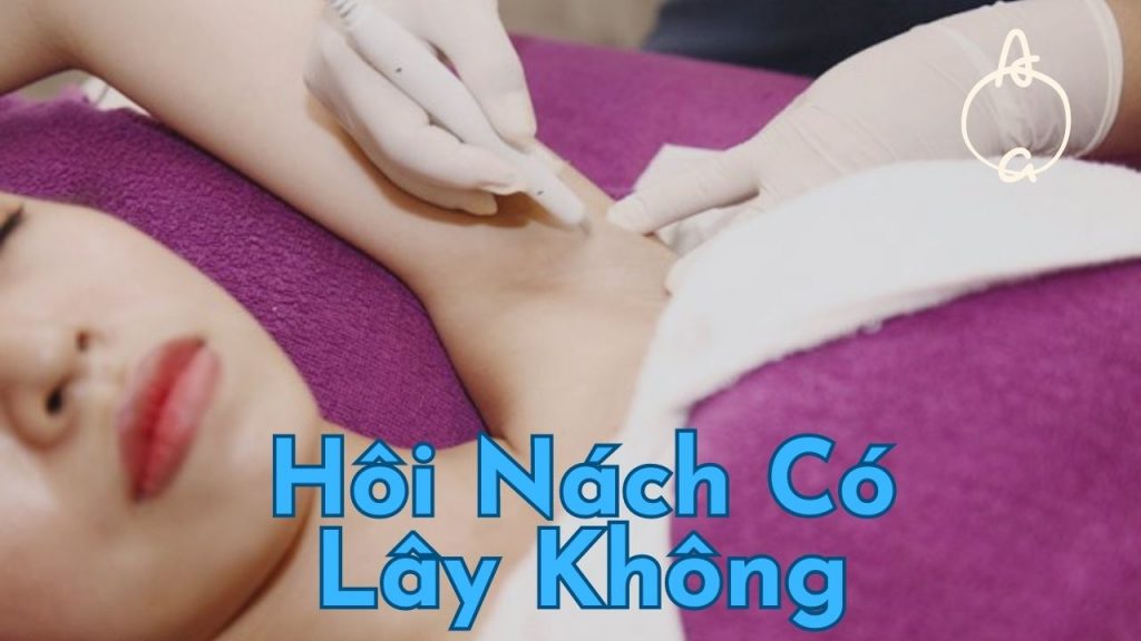 Hôi Nách Có Lây Không? Trị Dứt Điểm Không? 10 Cách Điều Trị