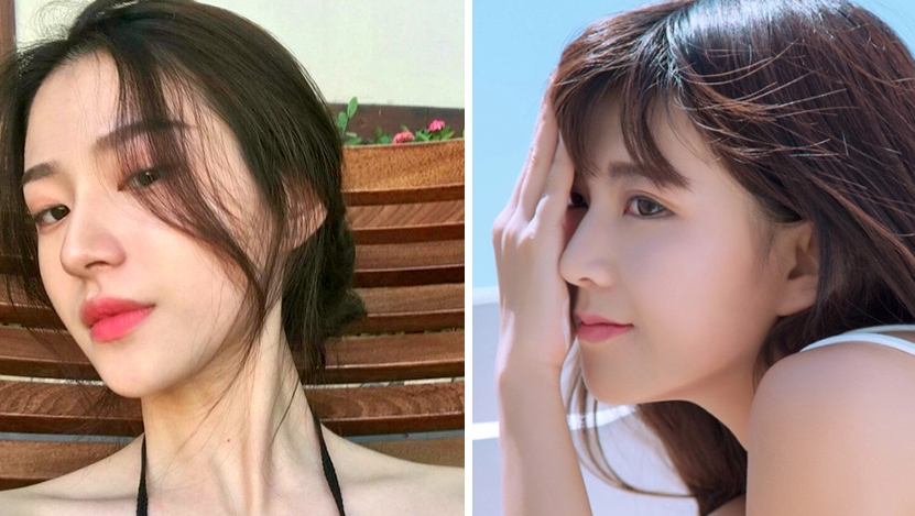 Chi Phí Nâng Mũi Hết Bao Nhiêu Tiền? Bảng Giá Mới Nhất 2023