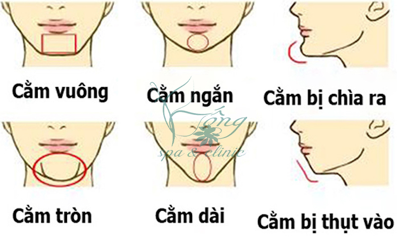 Cằm Vuông Mang Ý Nghĩa Vận Mệnh Gì? Cách Khắc Phục Hiệu Quả