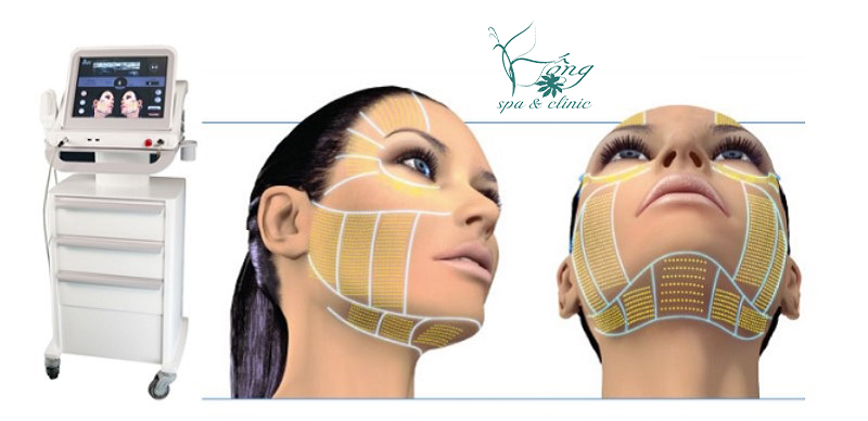 HIFU Là Gì? Lợi Ích, Công Dụng & Quy Trình Trẻ Hóa Làn Da