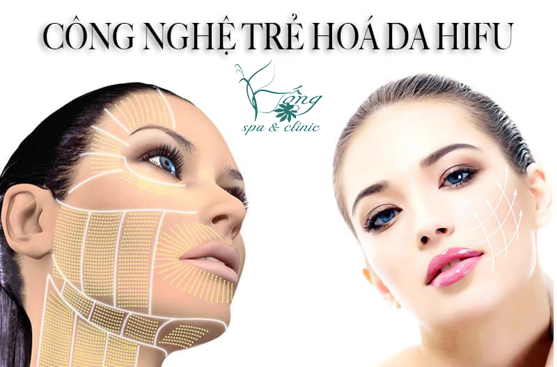 HIFU Là Gì? Lợi Ích, Công Dụng & Quy Trình Trẻ Hóa Làn Da