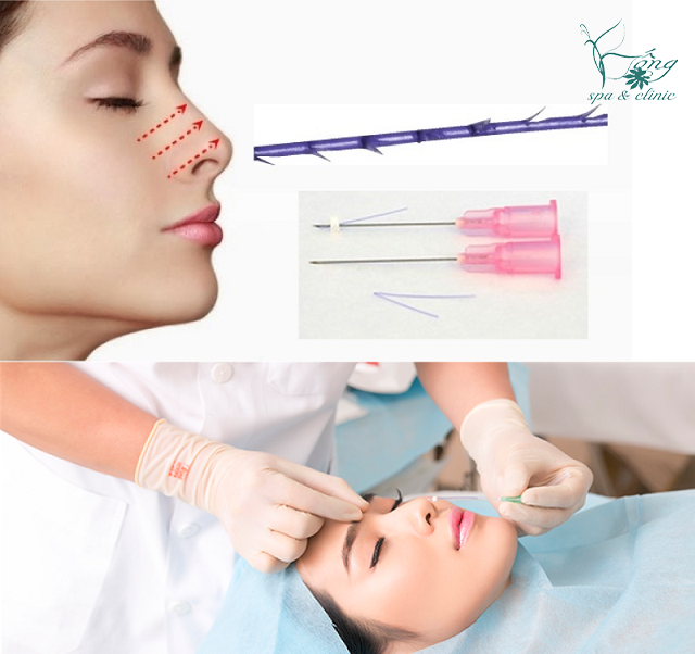 Review Nâng Mũi Bằng Chỉ Rủi Ro Không? Địa Chỉ Uy Tín TPHCM