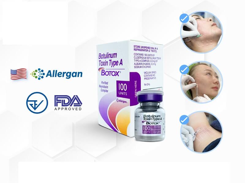 Botox Mỹ Allergan - Bống Spa
